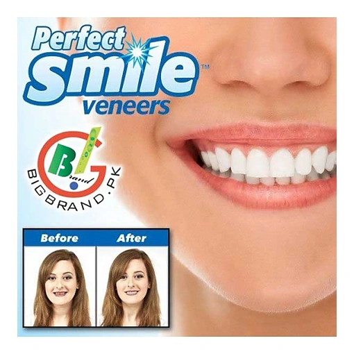 طقم أسنان علوي Perfect Smile قابل للإزالة – ابتسامة فورية بشكل طبيعي